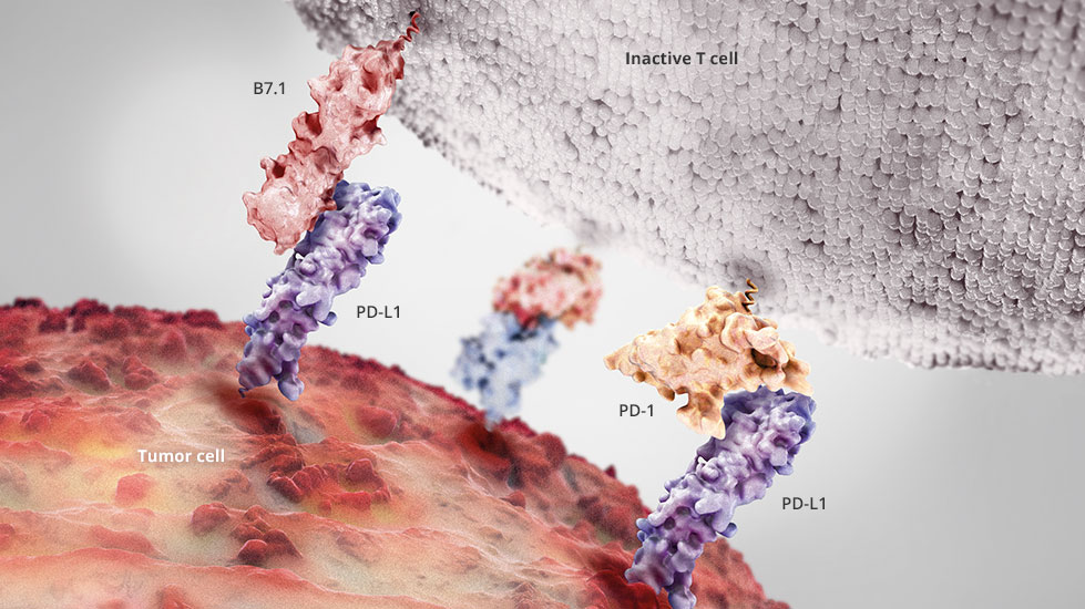 Detecția expresiei PD-L1 la nivelul celulelor epiteliale tumorale circulante  –     un marker util în selecția pacienților  pentru tratamentul cu inhibitori PD-1/PD-L1 în tumorile solide recent diagnosticate sau metastatice